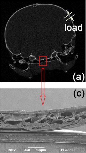 Auf den computertomographischen Darstellungen is der Schädel des Spechts zu erkennen. Im Vergleich zu uns und anderen Vogelarten besteht kaum Zwischenraum zwischen Schädeldecke und Hirn (oben). Im Querschnitt des Schädelknochens erkennt man die schwammige, mit Luftkammern durchzogene Struktur, welche die ausserordentliche Stabilität verleiht. (unten). | © Wang et al., PLoS One doi